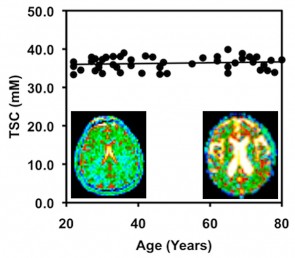 9.4 Tesla MRI Brain Image 2