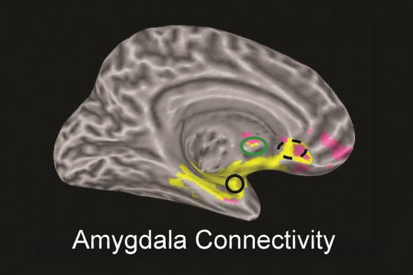 Amygdala Connectivity