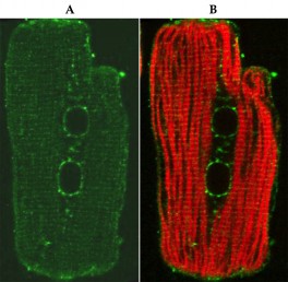 Heart muscle cells labeled for a specific protein (green) and the cytoskeleton (red).