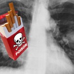 cigarette box labeled "poison" in front of a chest x-ray