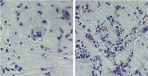 Left: Endothelial cells derived from stem cells treated with growth factors alone don’t form blood vessels. Right: Endothelial cells derived from stem cells treated with growth factors and glutamine withdrawal form organized blood vessels.