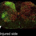 Increased inflammation (green) after injury in SOD1 rats