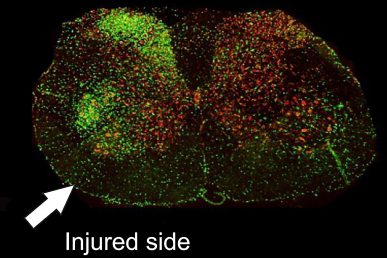 Increased inflammation (green) after injury in SOD1 rats
