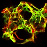 Fluorescence microscopy image of the lung with blood vessel endothelial.
