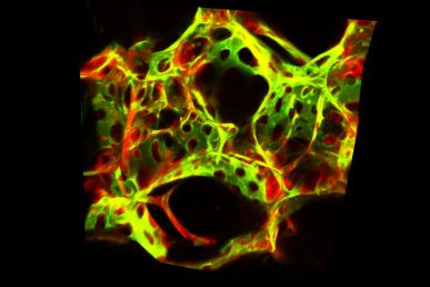 Fluorescence microscopy image of the lung with blood vessel endothelial.