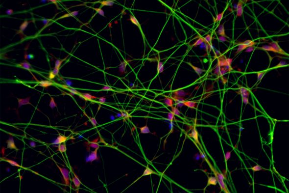 Studying stem-cell-derived neurons, created in the Regenerative