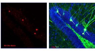 Computer images of memory neuron groups that were tracked with florescent labels display their activation during memory formation. Neurons expressing the tracking kit (right, green), co-express memory-related genes (left, red labeling).