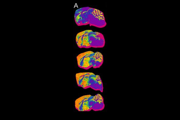 mages from UIC Associate Professor Stephanie Cologna’s lab were collected using an imaging technique called mass spectrometry to study how lipids are distributed across the brain. The colors highlight patterns of similarity in data showing lipid distribution and intensity.