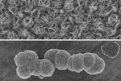 Two electron microscopy images show the “carpet” (top) and “sphere”