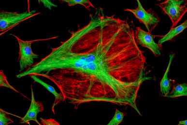 A fluorescent microscope image of a red cell with green and blue fibers cutting across.