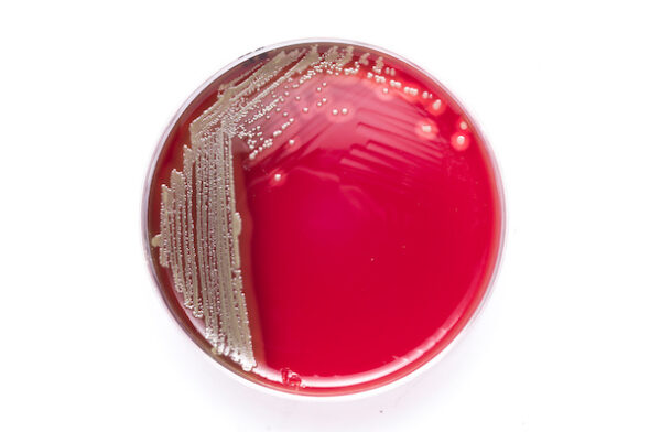 Streaks of tan bacteria on a red circle Petri dish.