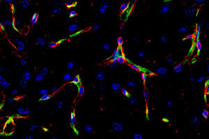 Blood vessel endothelial cells (green) and basement membrane (red) in the brain.