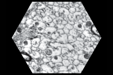 A black and white microscope image of blob-like cells pocked with dark grey and black circles.