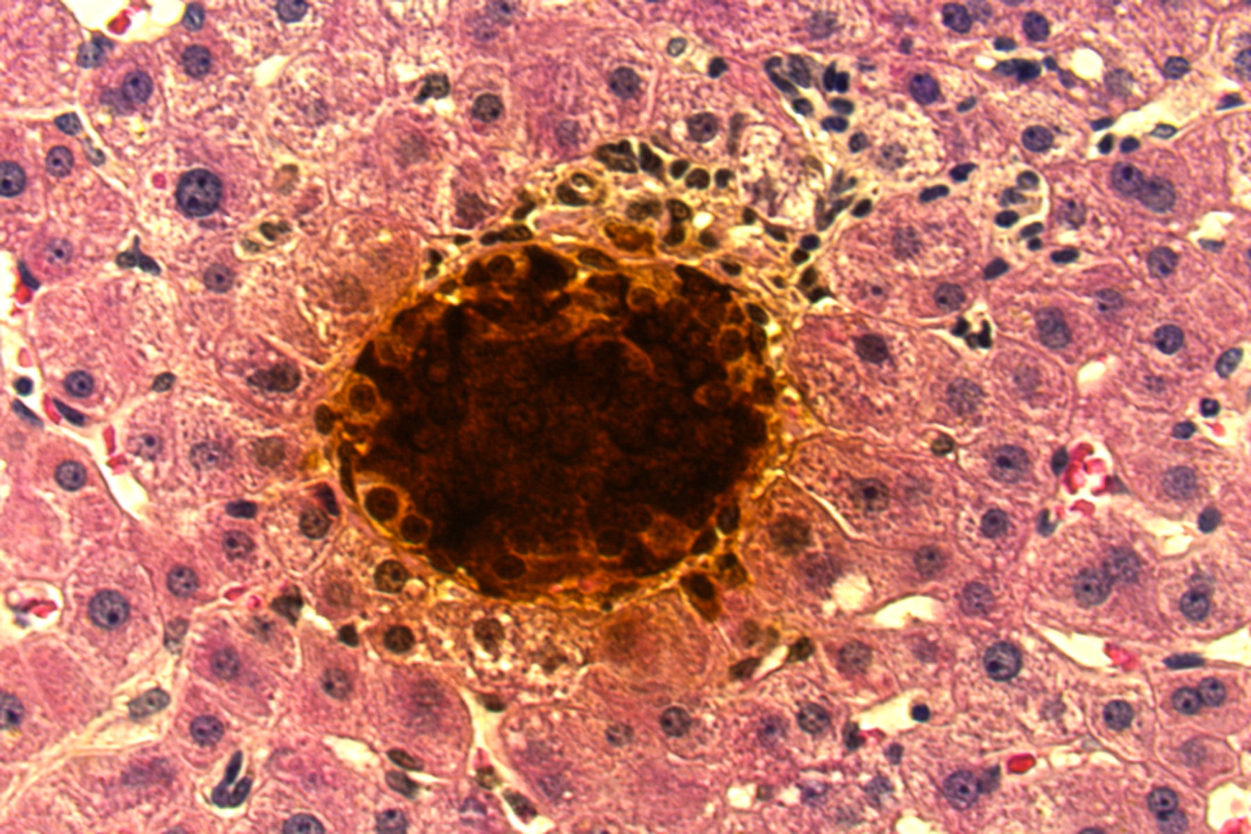 A series of pink islet cells surrounding a circle of brown, insulin filled cells.