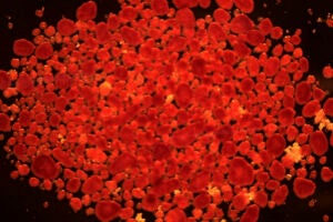 A grouping of red cells against a black background.